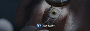 tratamento para catarata