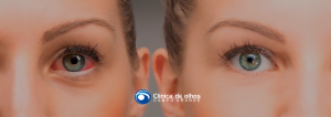 como o diabetes afeta a visão