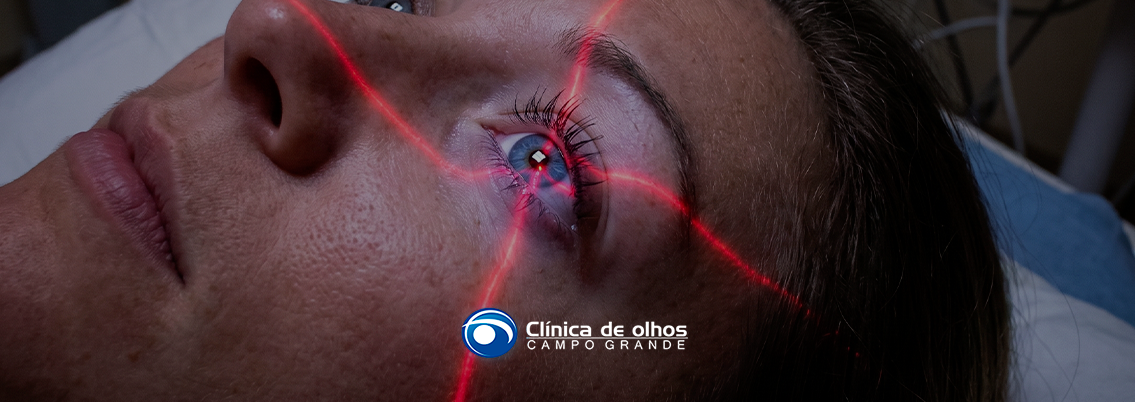 cirurgia refrativa vale a pena