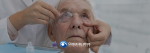 quanto tempo demora a recuperação da cirurgia de catarata